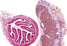 Un estudio de la UAM revela que la microbiota intestinal materna regula la función hormonal de la placenta