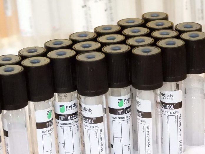 tubes-vacuum-3984050_1280